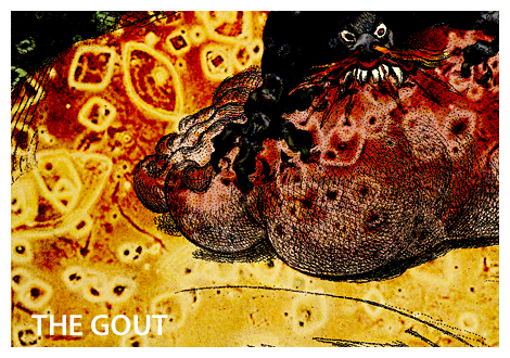 THE GOUT